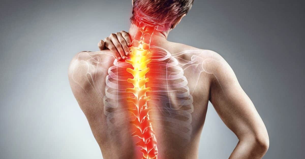 Get Rid of Mid Back Stiffness After Whiplash Without Surgery