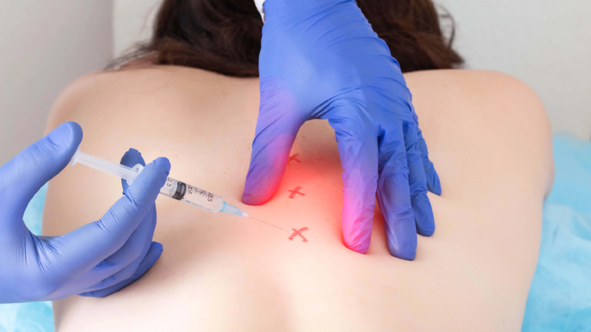 Knot Your Average Pain: How Trigger Point Injections in Reno Can Relieve Chronic Muscle Tension